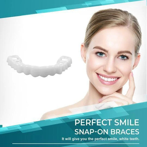 SMILELUX – Upper and Lower Veneer Set for Enhanced Smile Aesthetics