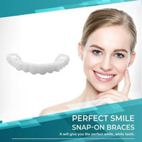 SMILELUX – Upper and Lower Veneer Set for Enhanced Smile Aesthetics