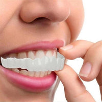 SMILELUX – Upper and Lower Veneer Set for Enhanced Smile Aesthetics