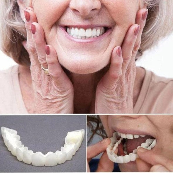 SMILELUX – Upper and Lower Veneer Set for Enhanced Smile Aesthetics