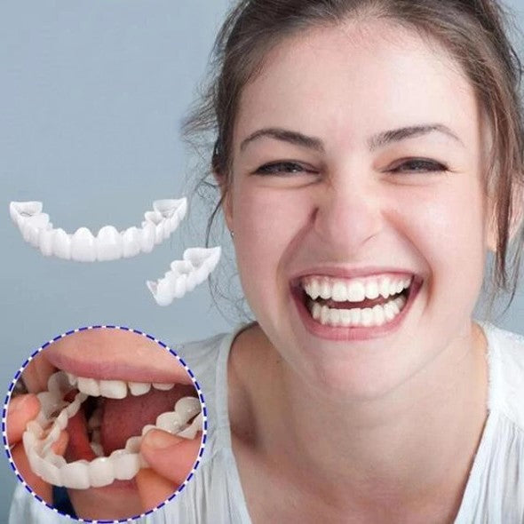 SMILELUX – Upper and Lower Veneer Set for Enhanced Smile Aesthetics