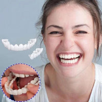 SMILELUX – Upper and Lower Veneer Set for Enhanced Smile Aesthetics