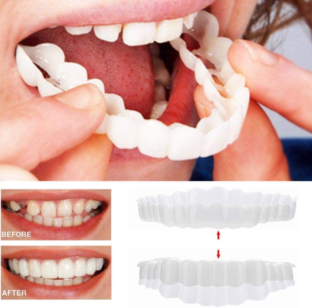 SMILELUX – Upper and Lower Veneer Set for Enhanced Smile Aesthetics