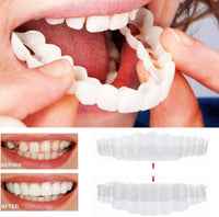 SMILELUX – Upper and Lower Veneer Set for Enhanced Smile Aesthetics