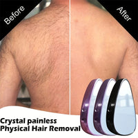 ELVORIA - Nano Crystal Hair Remover Reusable Painless Hair Eraser for Women Legs Light Beige Exfoliating Tool