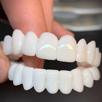SmileFlex - Aesthetic Dentures with White Dental Lenses for Confidence 0