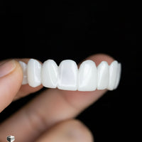 SmileFlex - Aesthetic Dentures with White Dental Lenses for Confidence 3